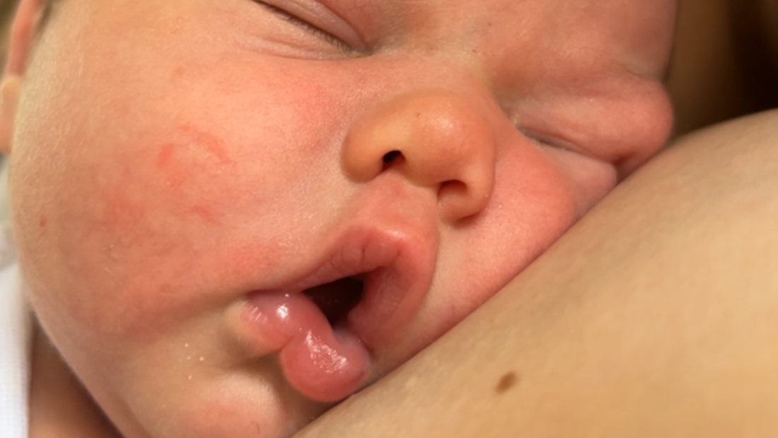 Breastfeeding mother and baby with information about lactose overload and oversupply